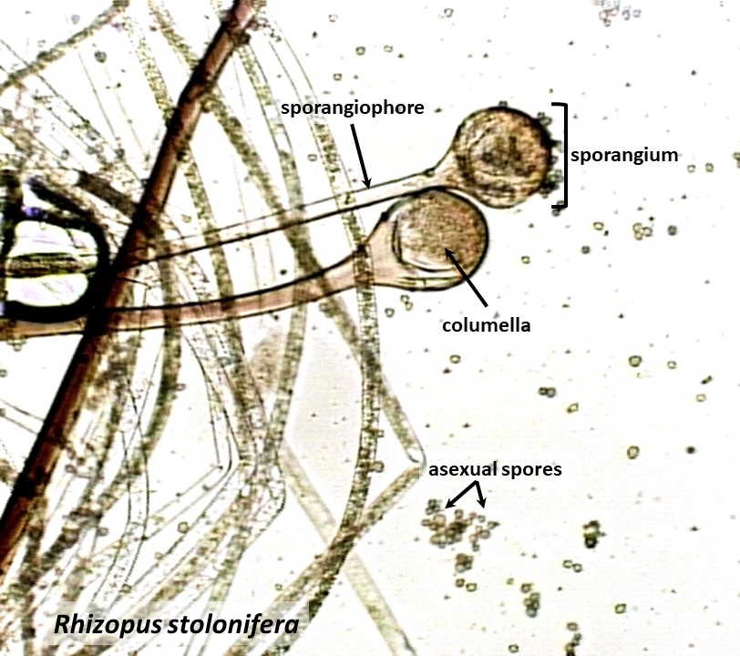 Chytrids and Zygote Fungi